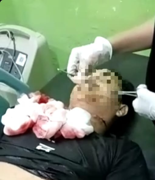 Nabrak Kerbau, Seorang Pengendara Sepedamotor Tewas Di Simeulue