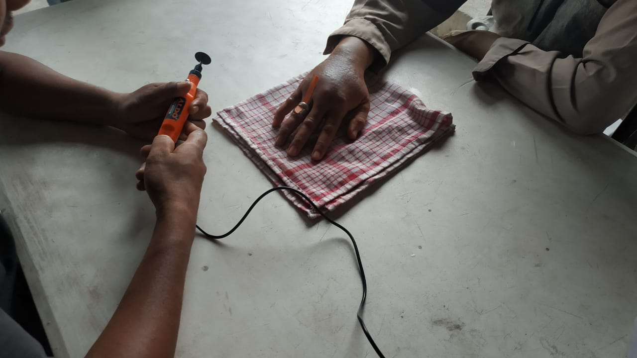 Cincin Tak Bisa Lepas, Minta Bantu Damkar