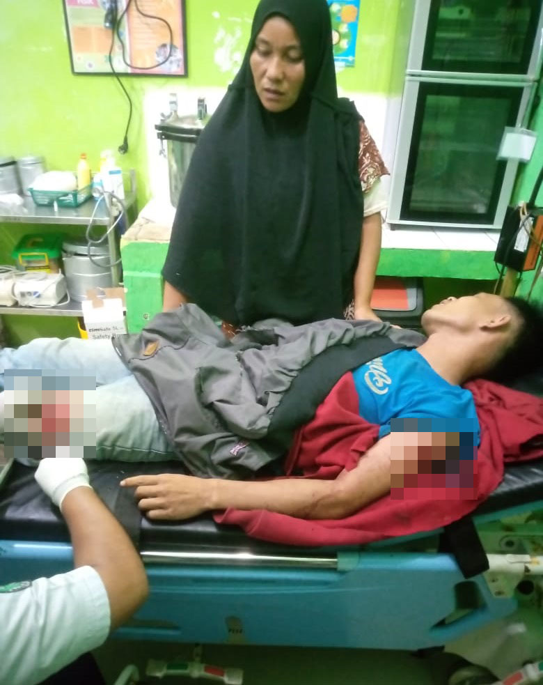 Begal Hebohkan Simeulue, Seorang Warga Dibacok Di Lengan Dan Paha