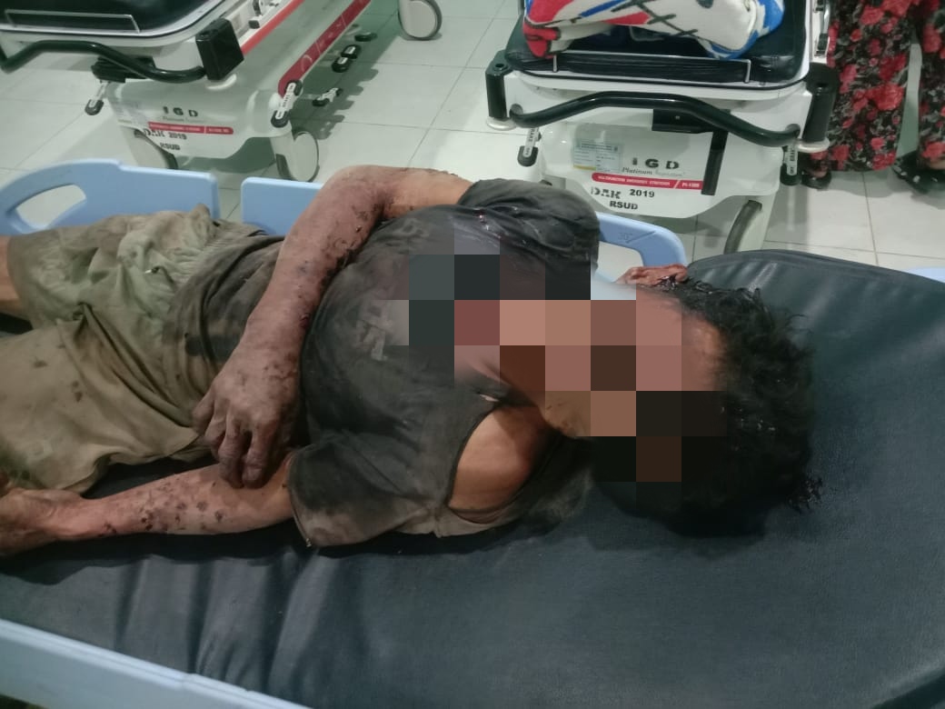 Perampok Sadis Beraksi Di Perbatasan Aceh, Korban Disiksa Uang Puluhan Juta Dikuras