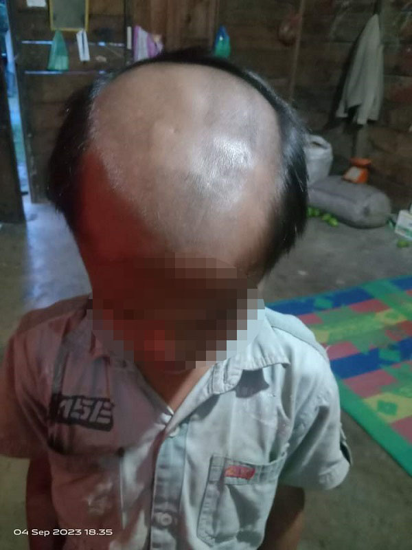 Guru Di Samosir Cukur Rambut Muridnya Jadi Botak Setengah