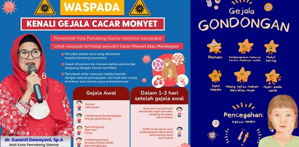 Gondongan Penyakit Menular Menyerang Anak Usia 2-12 Tahun