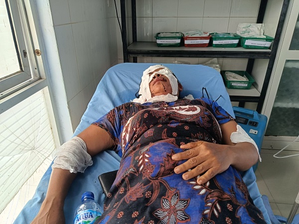 Melarikan Diri, Pelaku Penyiraman Air Keras Terus Diburu