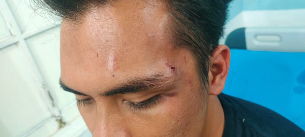 Anak Anggota DPRD Dairi Dikeroyok Di Sidikalang