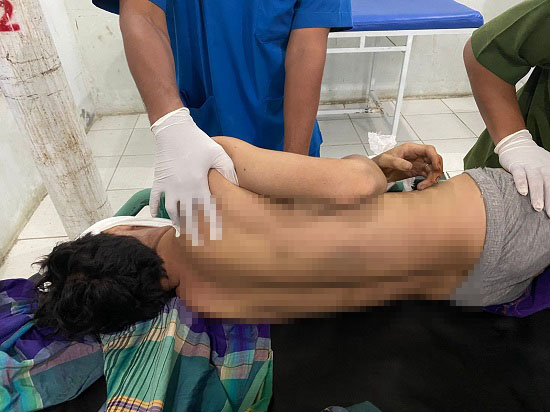 Seorang Warga Subulussalam Meninggal Bunuh Diri