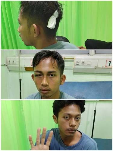 Tiga Mahasiswa Asal Sumatera Utara<br>Korban Pembacokan Di Kos-kosan