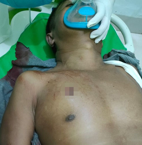 Mantan Anggota DPRD Langkat Tewas Ditembak