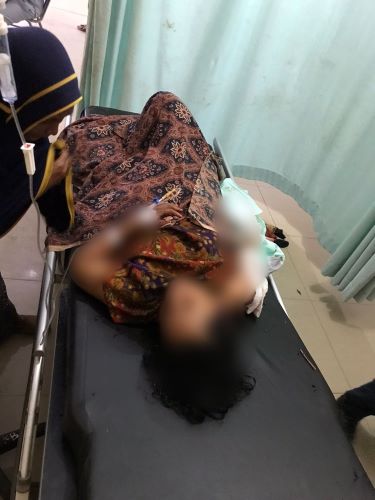 Suami Bacok Istri Di Aceh Singkil, Hanya Gara-gara Masalah Ekonomi