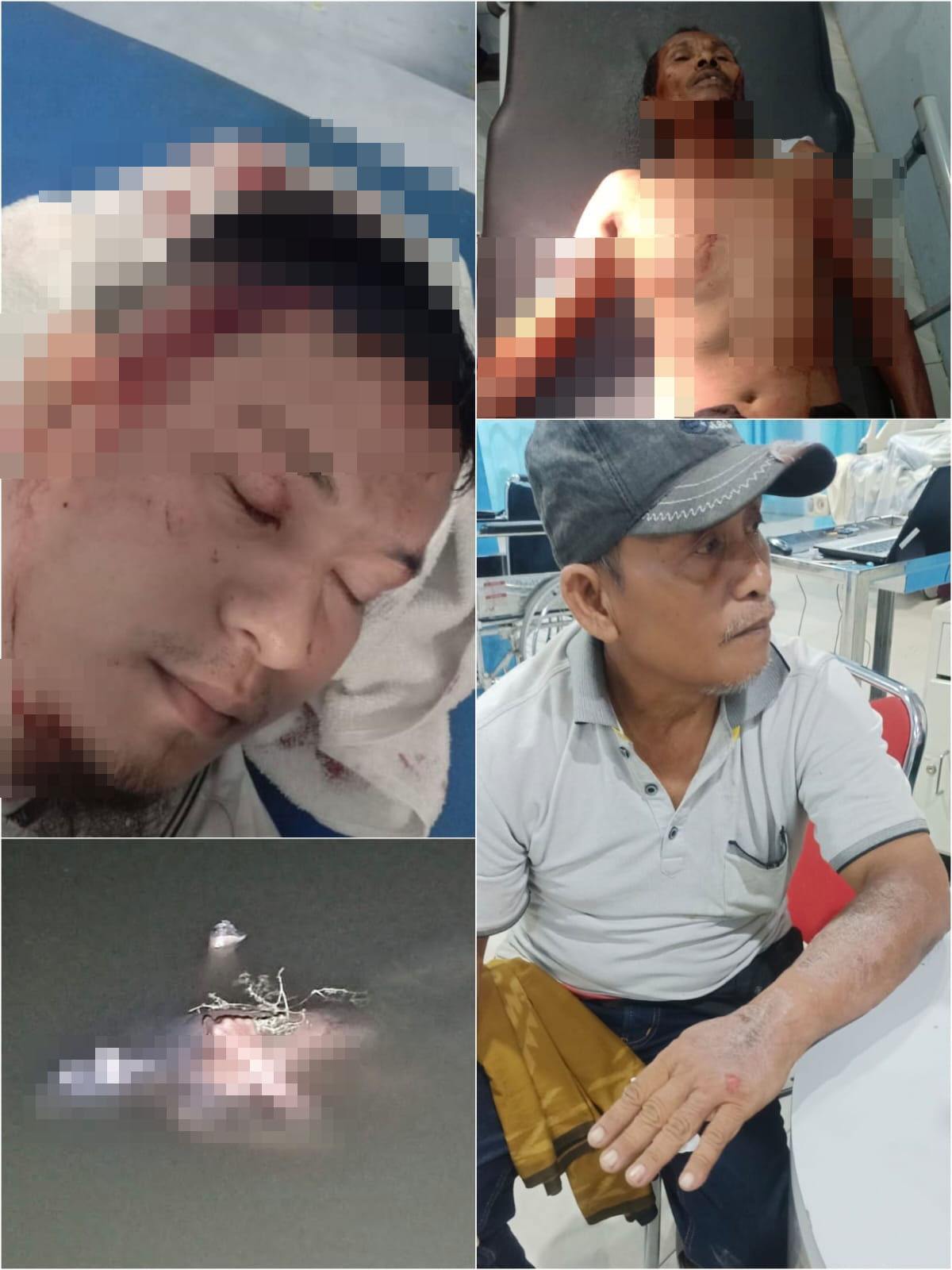 Seorang Pemuda Bacok 4 Pria, Satu Meninggal