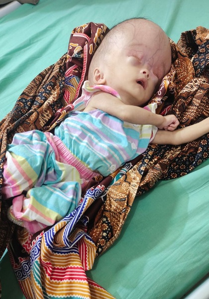 Respon Cepat Pj Bupati Agara Terhadap Pasien Kurang Mampu