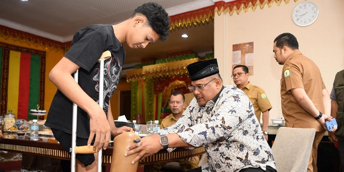 Pj Gubernur Serahkan Bantuan Kaki Palsu Untuk Guntur, Remaja Yang Alami Amputasi