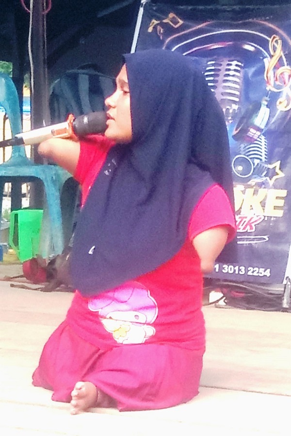 Cacat Fisik Tak Membuat Ayu Merasa Inferior