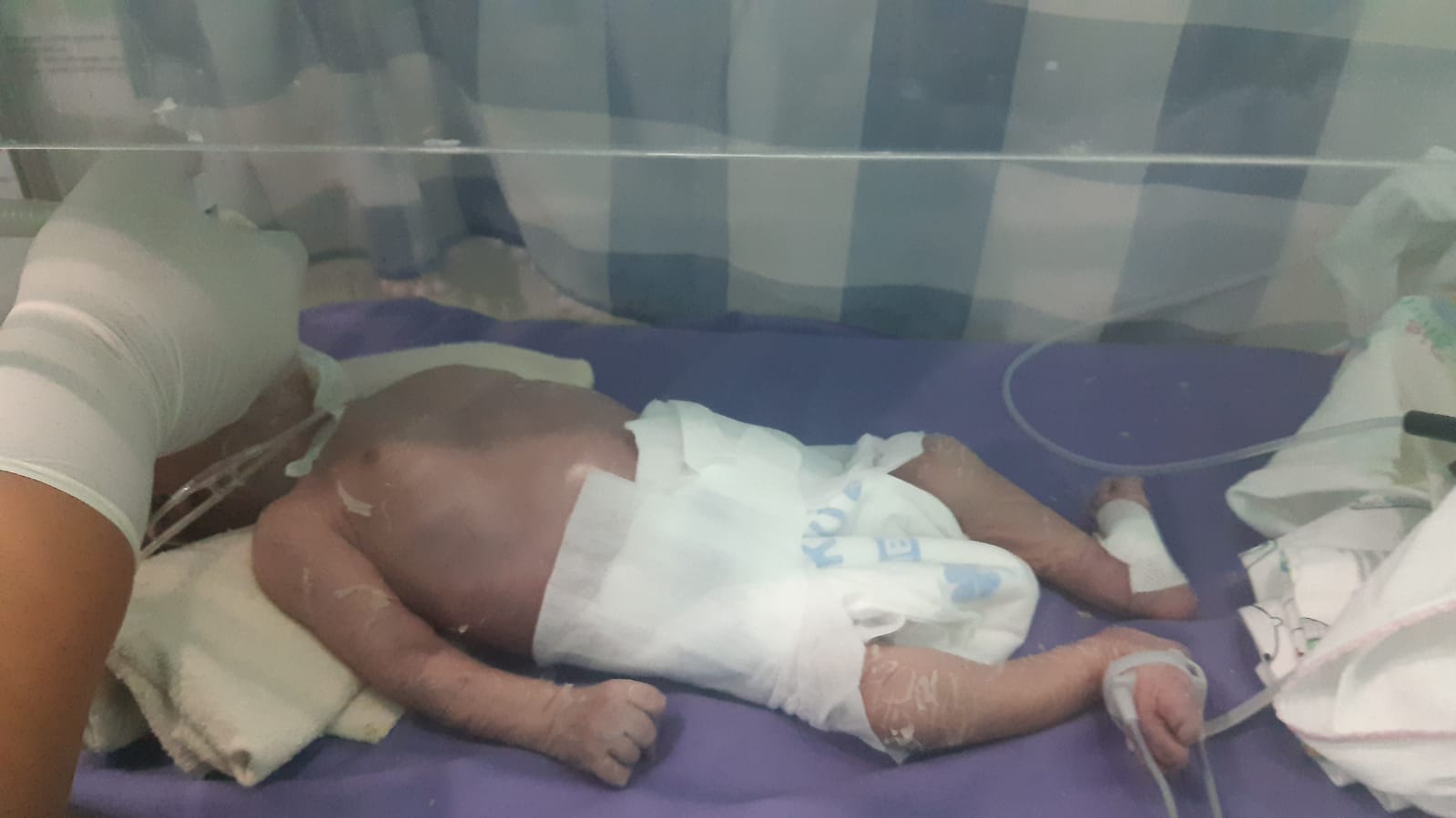 Bayi Ditemukan Di Masjid Meninggal Akibat Sesak Napas