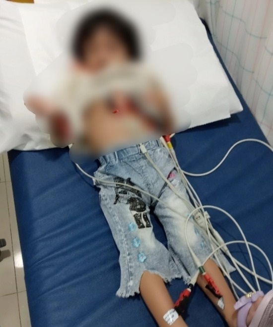 Bocah Abdya Bocor Jantung Butuh Uluran Tangan