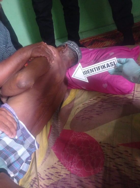 Mabuk Tuak, Petani Di Sergai Tewas Dalam Parit