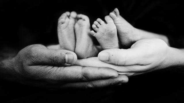 Bayi Kembar Siam Asal Batubara Hasan Dan Husin Meninggal Dunia