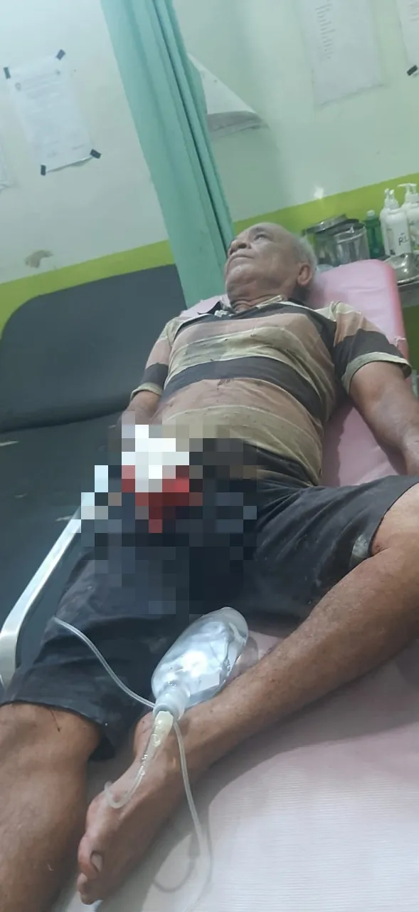 Diduga Sengketa Tanah, Jari Warga Abdya Putus Ditebas Parang