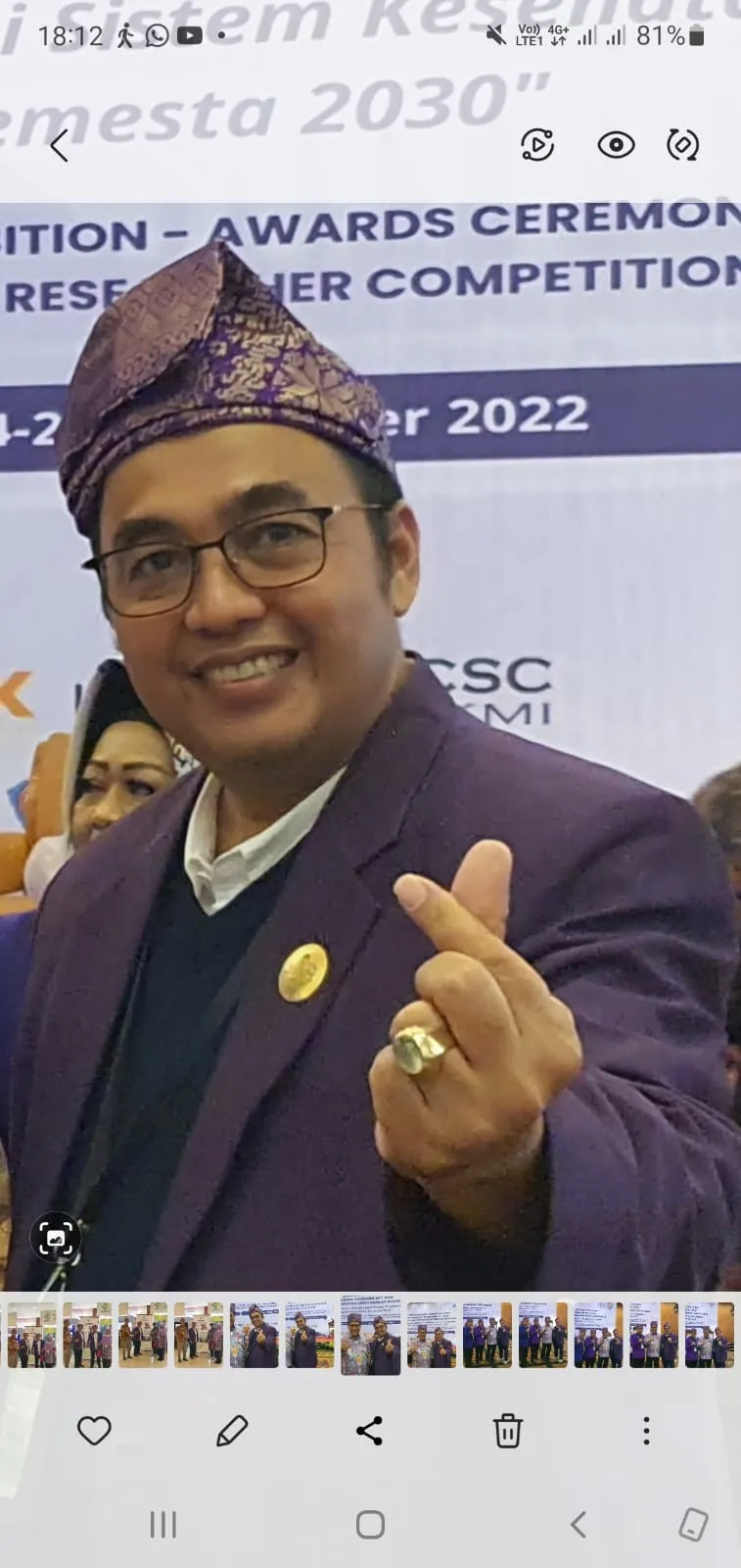 Penyebab Stunting di Sumut Tidak Bisa Diseragamkan