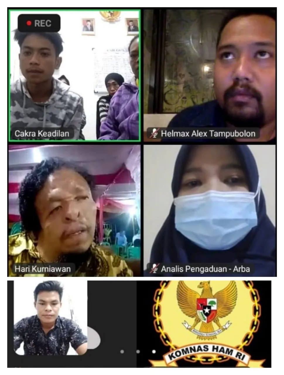 Komnas HAM RI Terima Laporan Pengaduan Korban Penembakan Oknum Polisi Di Medan Labuhan