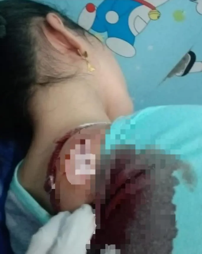 Wanita Terkapar Kena Clurit Begal di Jl. Cemara Abadi