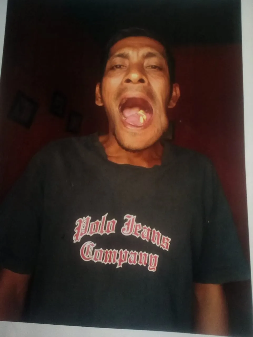 Camat Siabu Minta Bantu Warga Miskin Penderita Tumor