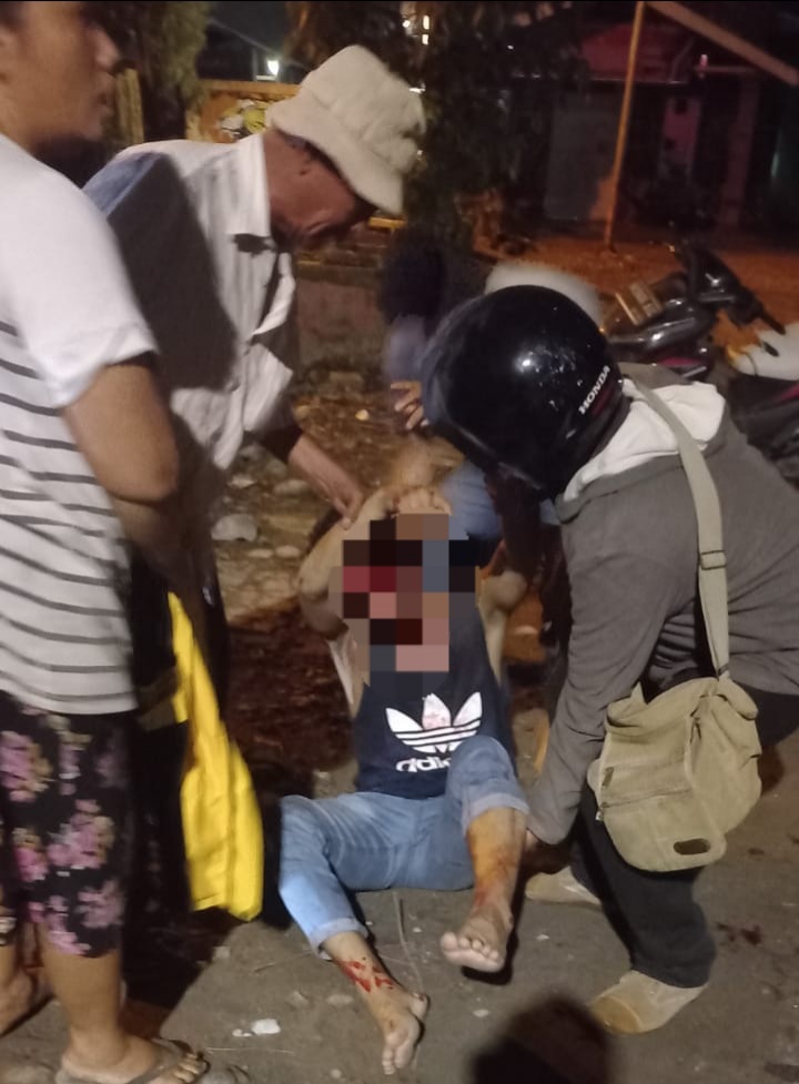 Gundukan Jalan Di Perumnas Mandala Sebabkan Pengendara Sepedamotor Luka Parah