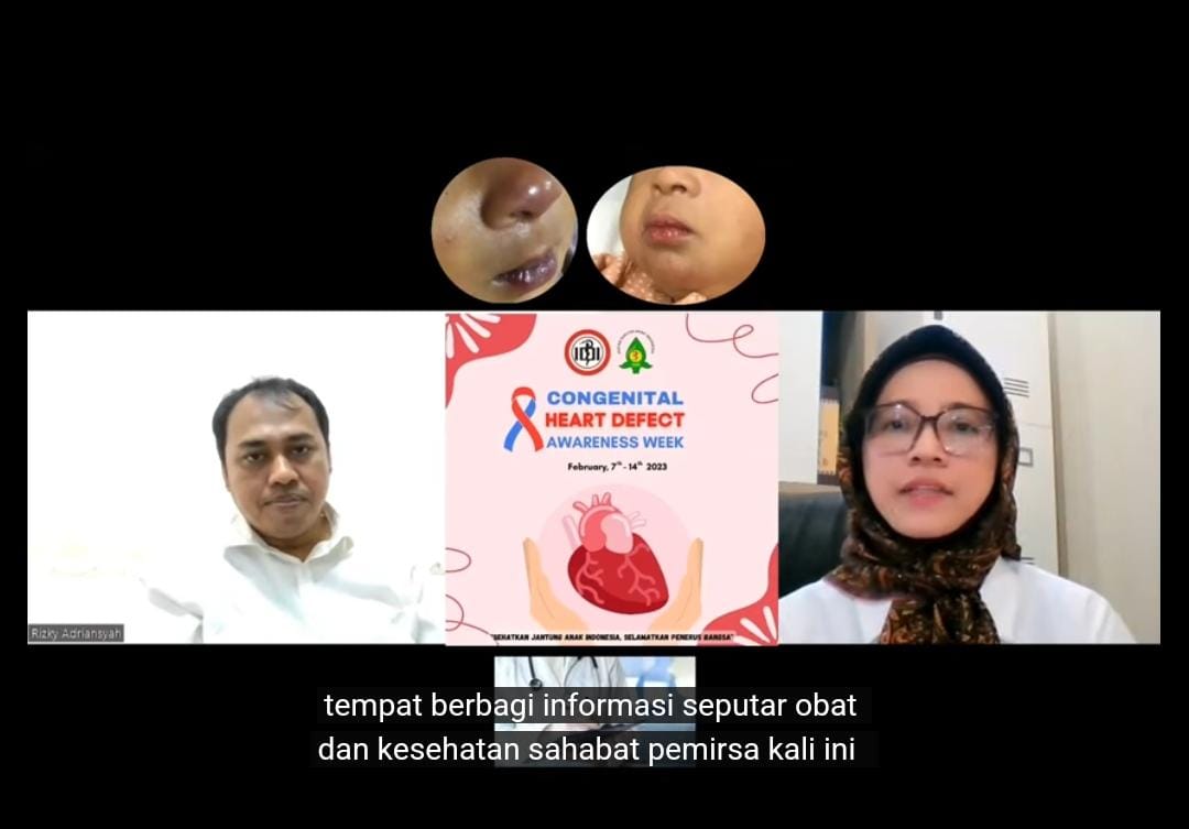 Deteksi Dini Ketahui Jantung Bocor Bawaan Pada Anak