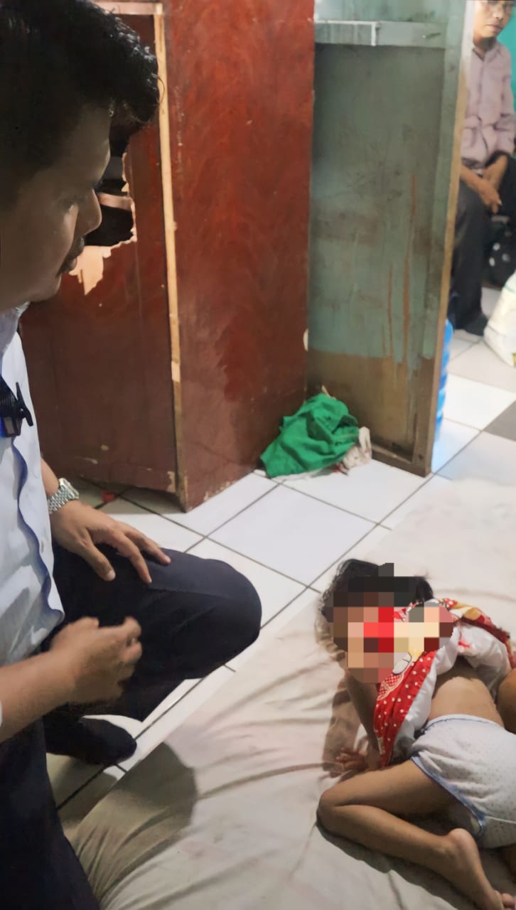 Prof Ridha Dharmajaya Kunjungi Balita Penderita TBC Tulang