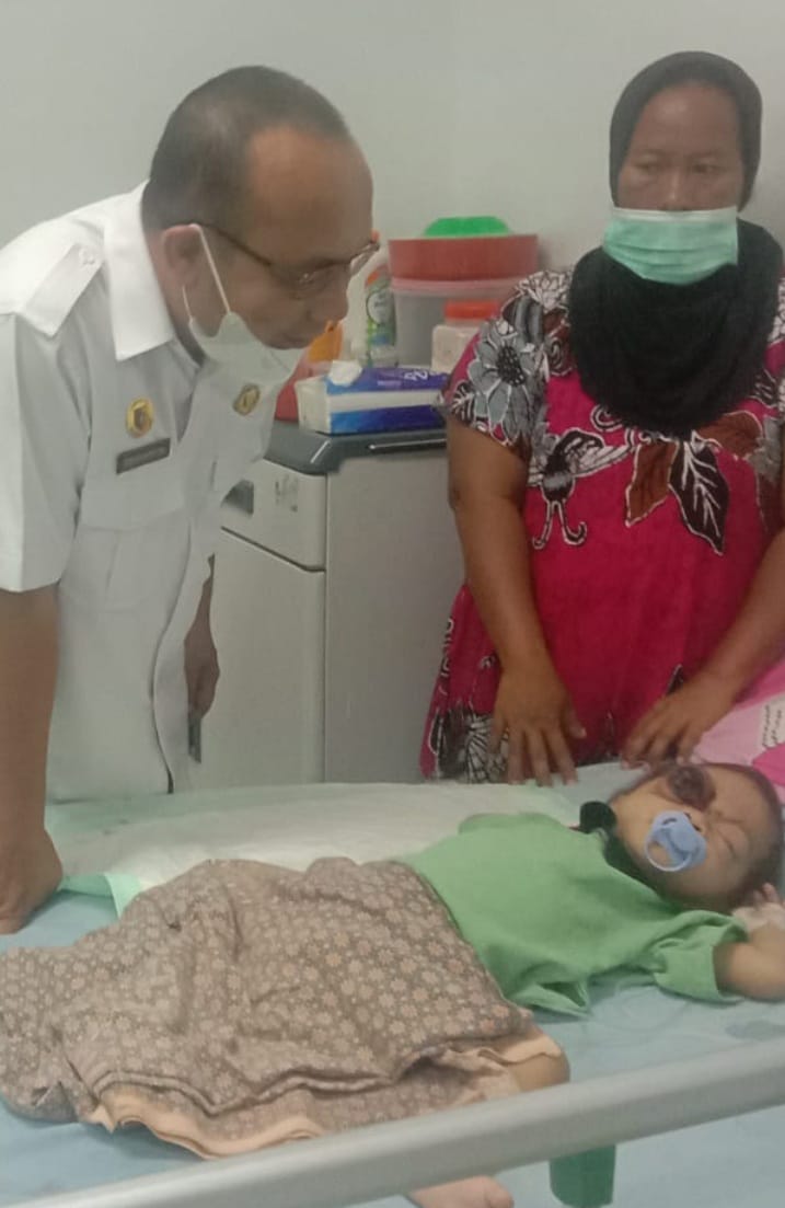 Alifah, Balita Tanjungtiram Menderita Pembengkakan Mata Jalani Perawatan