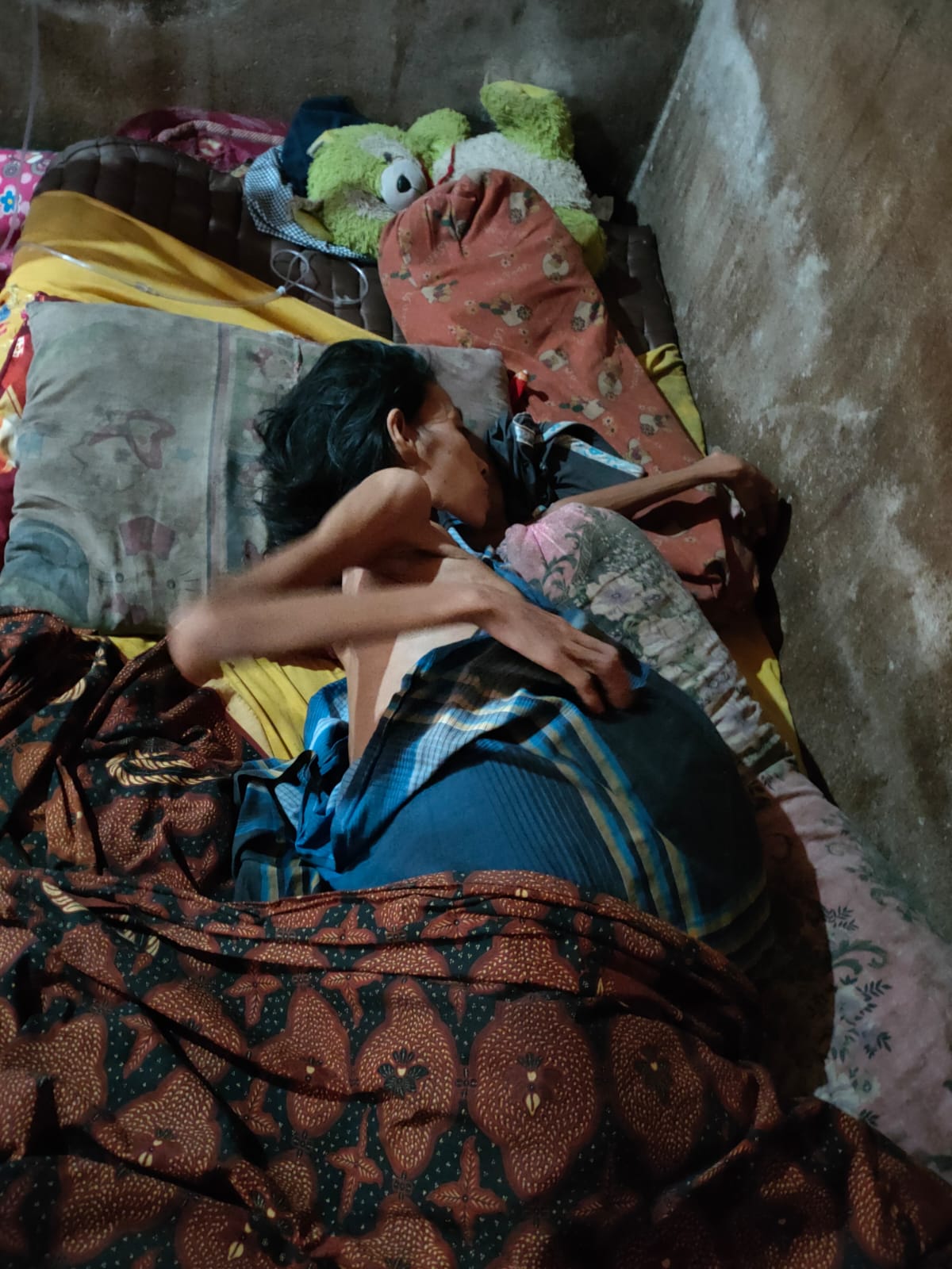 Di Madina, 3 Warga Derita Sirosis Hepatitis