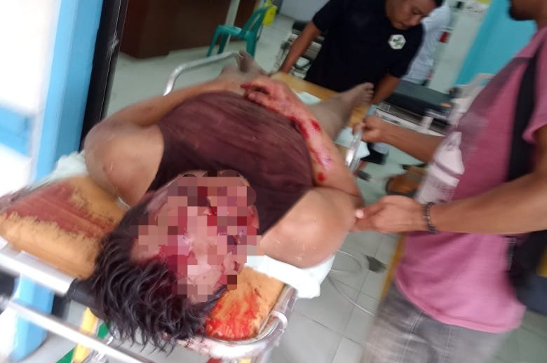 Pelaku Curas Babak Belur Dihakimi Massa