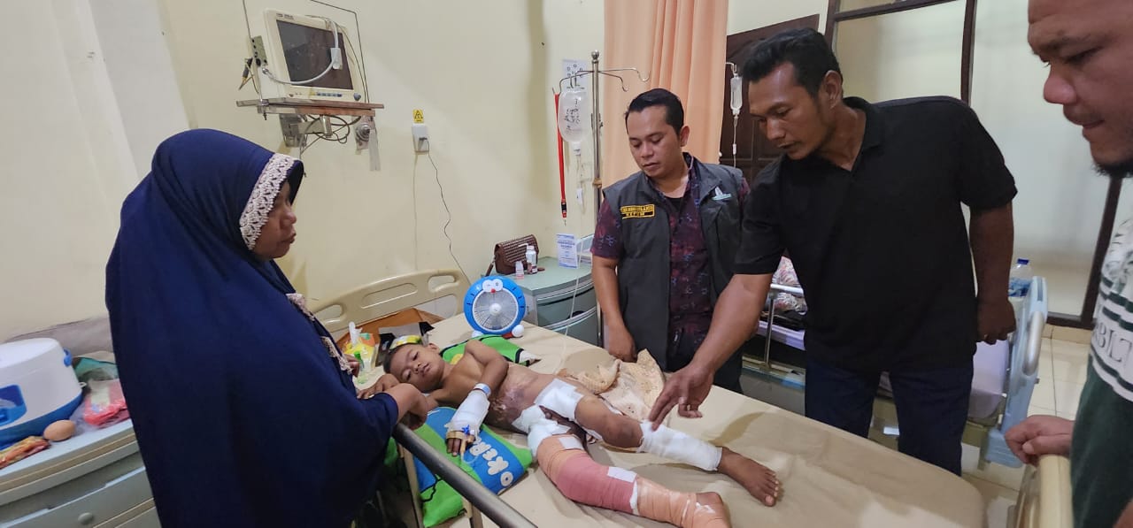 Ketua HIPMI Palas Jenguk Dan Bantu Korban Luka Bakar Di RS