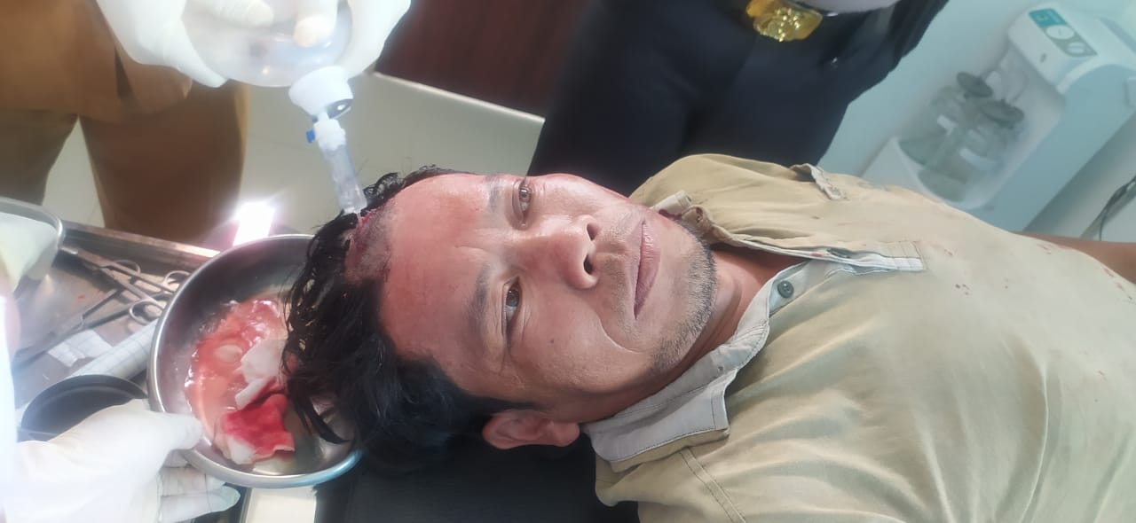 Sedang Duduk Di Warung, Pria 50 Tahun Ditembak OTK Di Tigarunggu