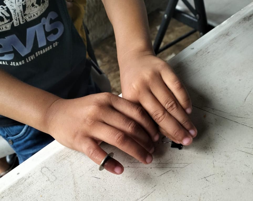 Ada-ada Saja, Bocah Masukkan Ring Baut Ke Jari Kelingking