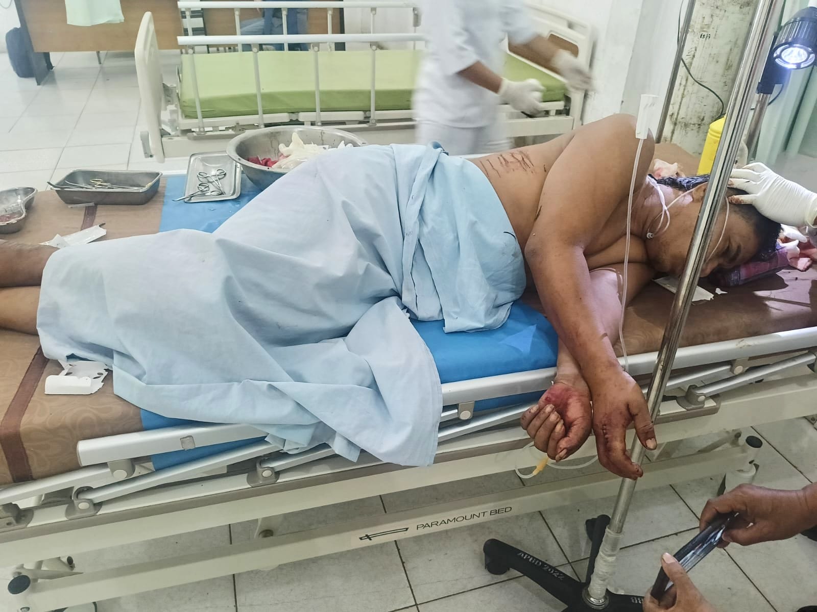 Makmur Nyaris Tewas Usai Tagih Utang Rp100 Ribu