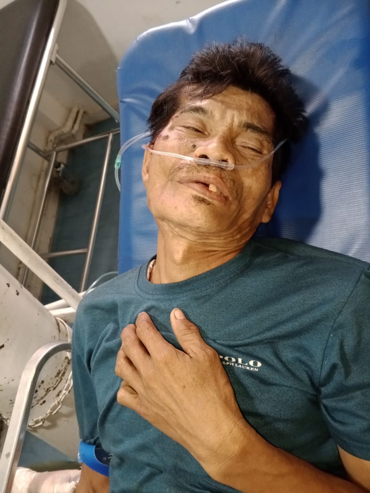 Beredar Foto Tanpa Identitas Di Simeulue Diisukan Korban Tabrak Lari