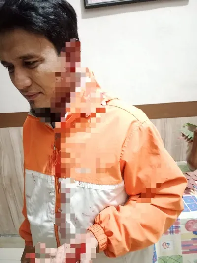Aliansi Ormas Islam Sumut Desak Kapolres Labuhanbatu Tangkap Pelaku Penganiayaan Aktivis Ormas Islam