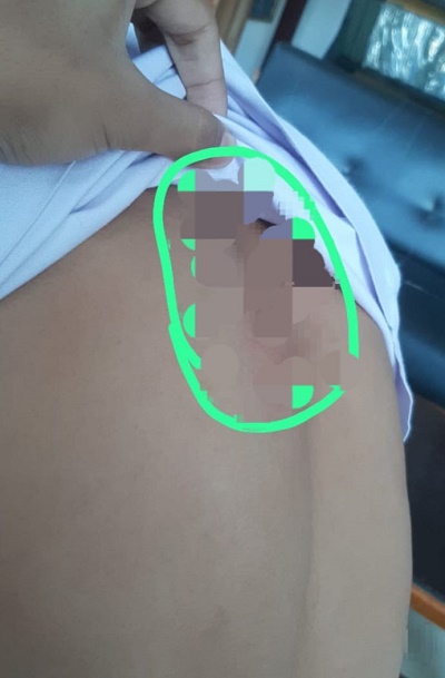 Santri Pesantren Darularafah Dianiaya, Orangtua Ngadu Ke Polrestabes Medan