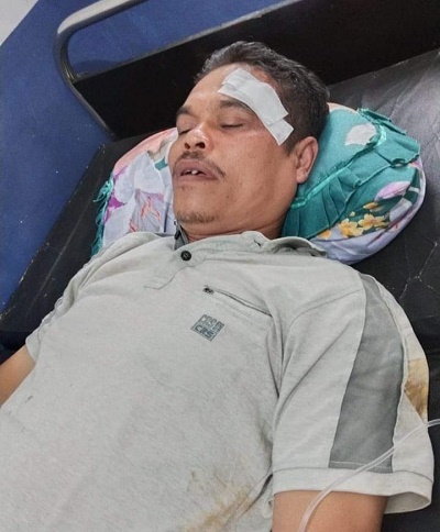 Saksi Prabowo - Gibran Digebukin Pasca Hitung Ulang di Tapanuli Tengah