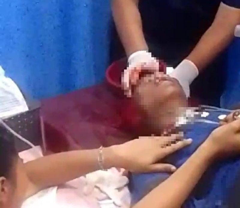 Bentrok Di Belawan Kambuh Lagi, 1 Kritis Tertembak