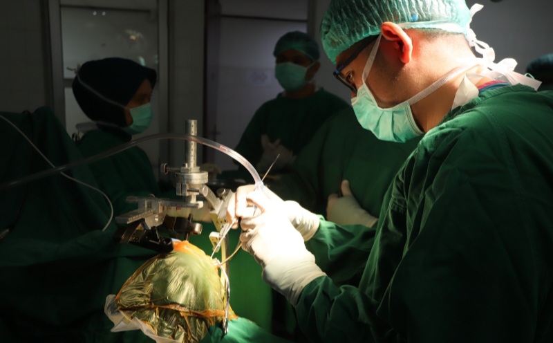 RS Adam Malik Berhasil Lakukan Operasi Stereotaktik Tumor Biopsi Perdana