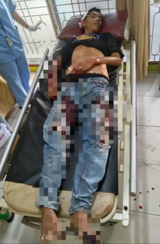 Tawuran Antargeng Motor Di Sunggal, 1 Tewas Luka Bacok