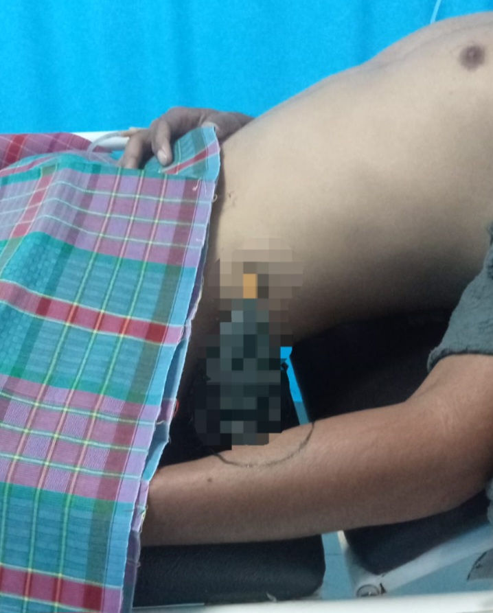 Kapolres Pelabuhan Belawan Selidiki Pelaku Tawuran Di Bagandeli