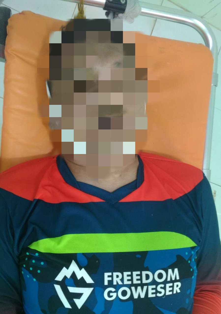 Diduga Kelelahan, Peserta Gowes Langsa Adventure Bike 8 Meninggal Dunia