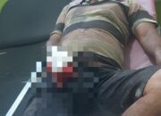 Diduga Sengketa Tanah, Jari Warga Abdya Putus Ditebas Parang