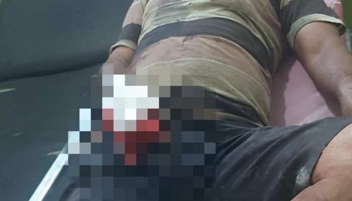 Diduga Sengketa Tanah, Jari Warga Abdya Putus Ditebas Parang