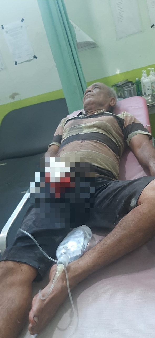 Diduga Sengketa Tanah, Jari Warga Abdya Putus Ditebas Parang