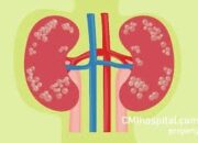 11 Anak Di Sumut Menderita Gagal Ginjal Akut Misterius