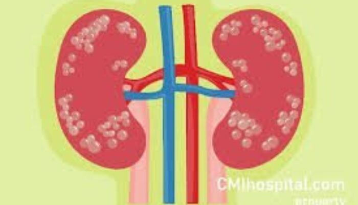 11 Anak Di Sumut Menderita Gagal Ginjal Akut Misterius