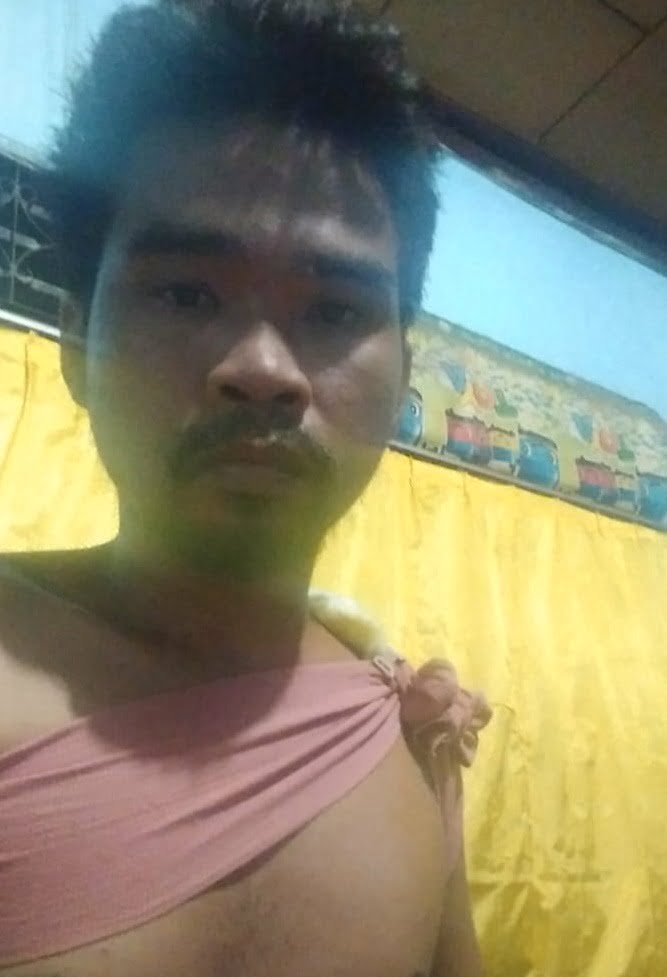 GRAHA Sandi korban penganiayaan oknum sekuriti. Waspada/Ist